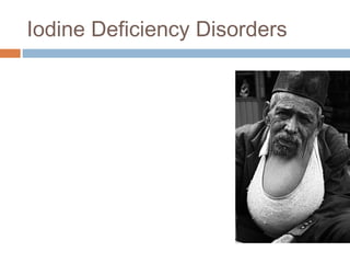 Iodine Deficiency Disorders
 