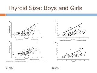 Thyroid Size: Boys and Girls
24.6% 20.7%
 