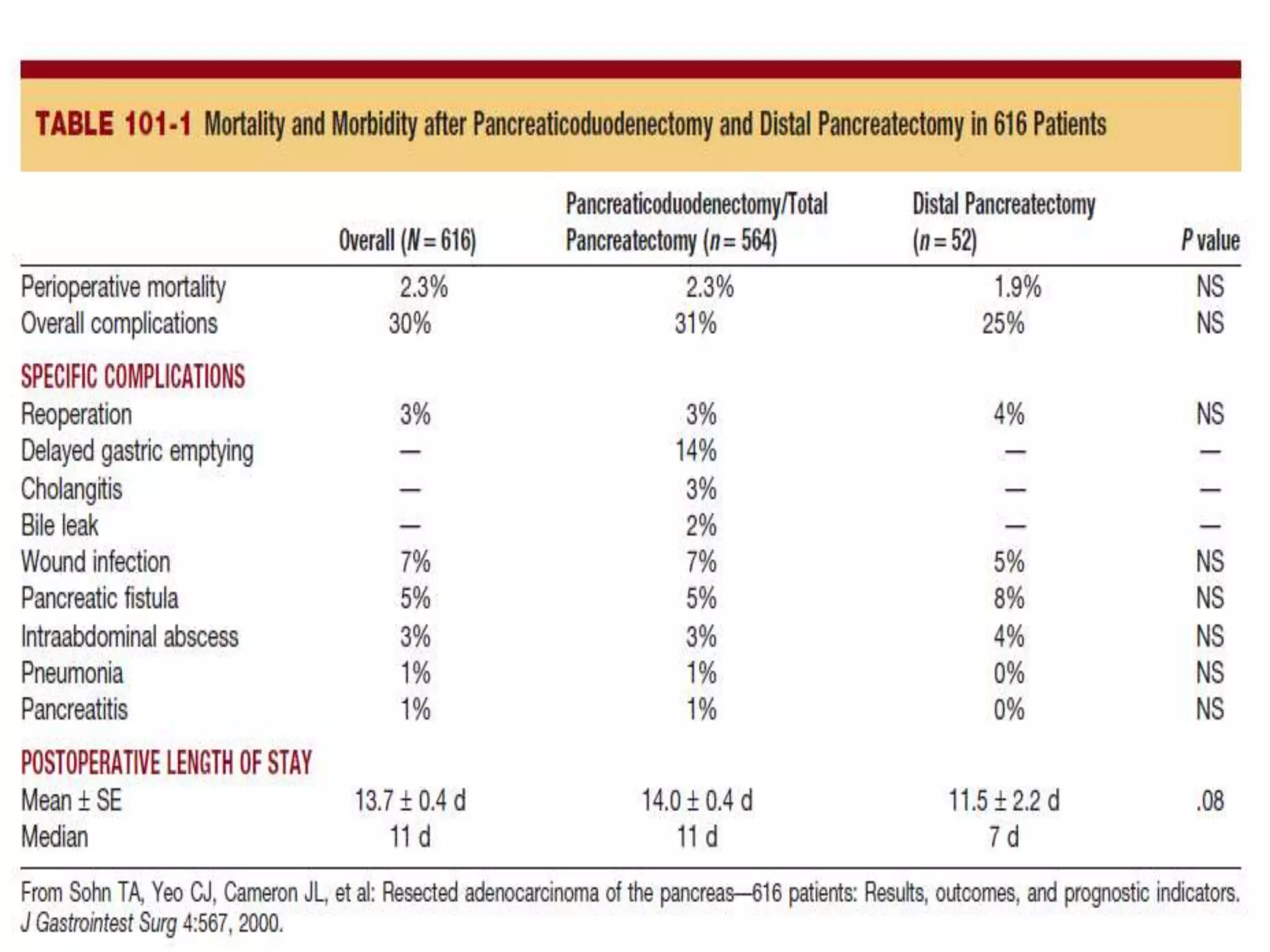 Prevention and management of complications of pancreatic surgery | PPTX