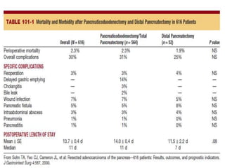 Prevention and management of complications of pancreatic surgery | PPTX
