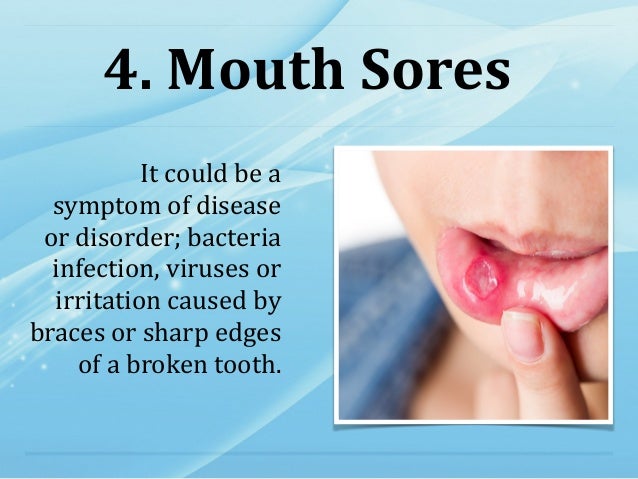 Tmj Teeth Pain Cold Drinks Tmj Teeth Pain Cold Drinks