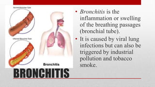 PREVENTION, DETECTION AND TREATMENT OF DISEASES OF THE RESPIRATORY ...