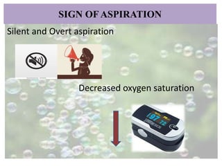 Prevention of aspiration 2 | PPTX
