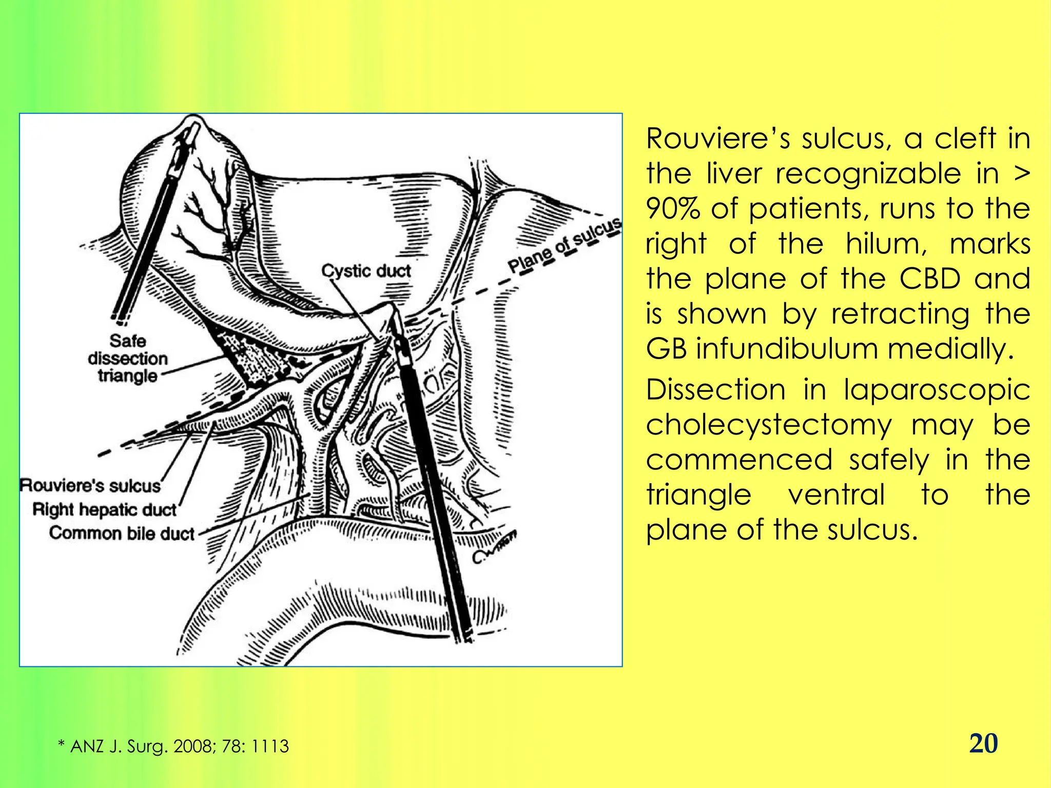 Prevention of Bile Duct Injury in Difficult Lap Chole.pptx
