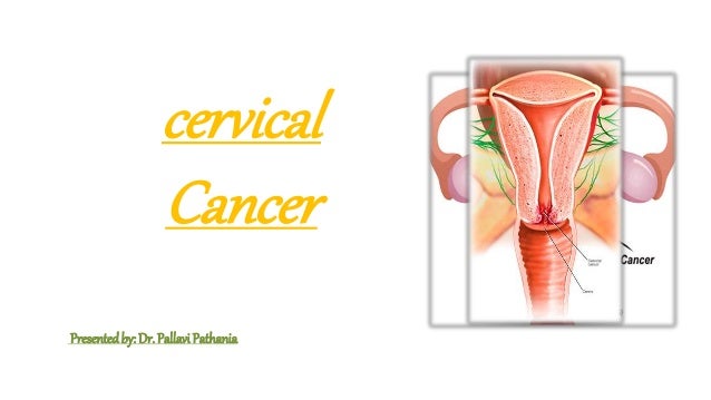 Cervical Cancer Incidence Prevalence Research Study