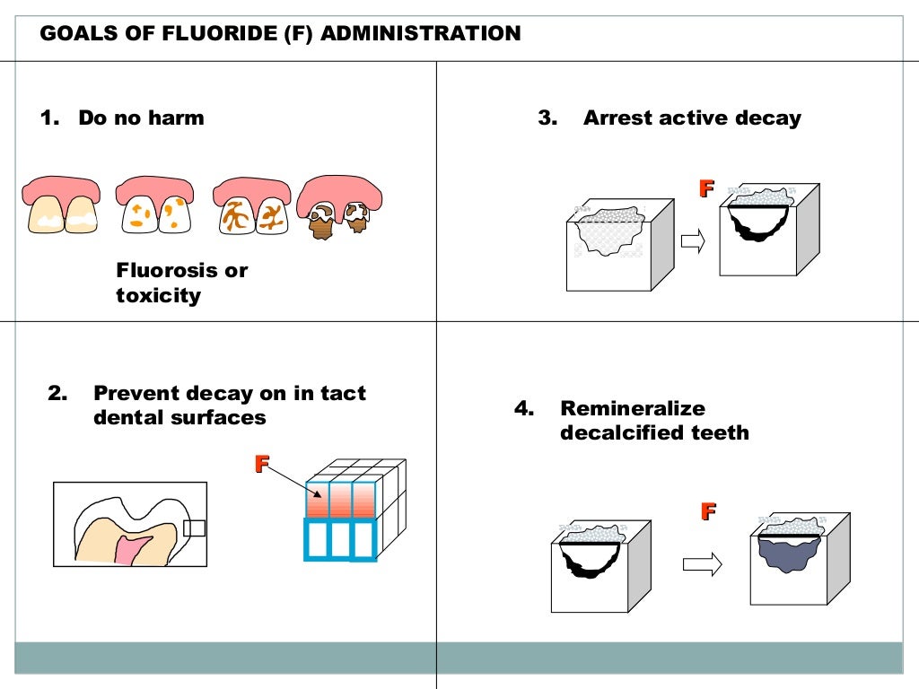 Prevention of Dental caries