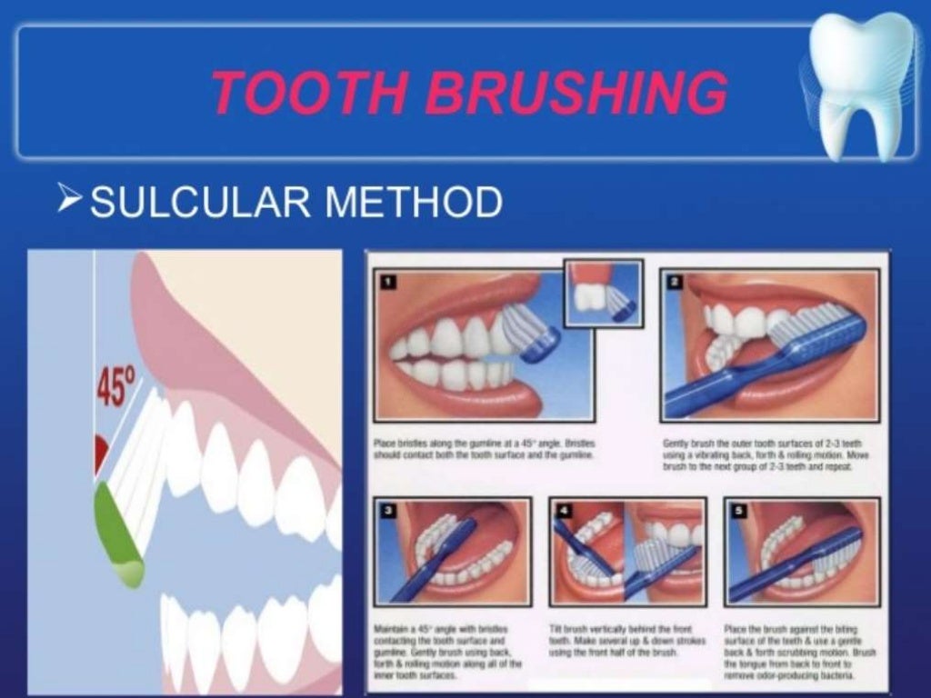 Prevention of dental caries