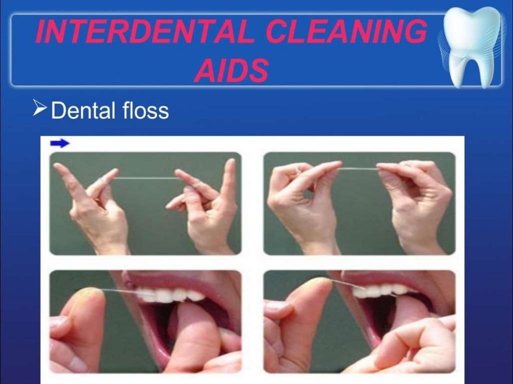 Prevention of dental caries