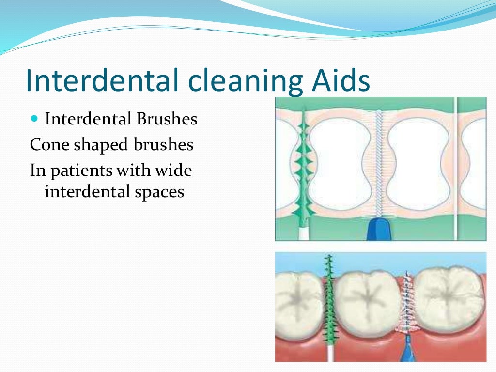 Prevention of dental caries