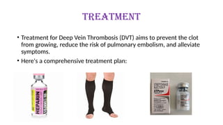 Comprehensive Guide to Prevention and Treatment of Deep Vein Thrombosis ...