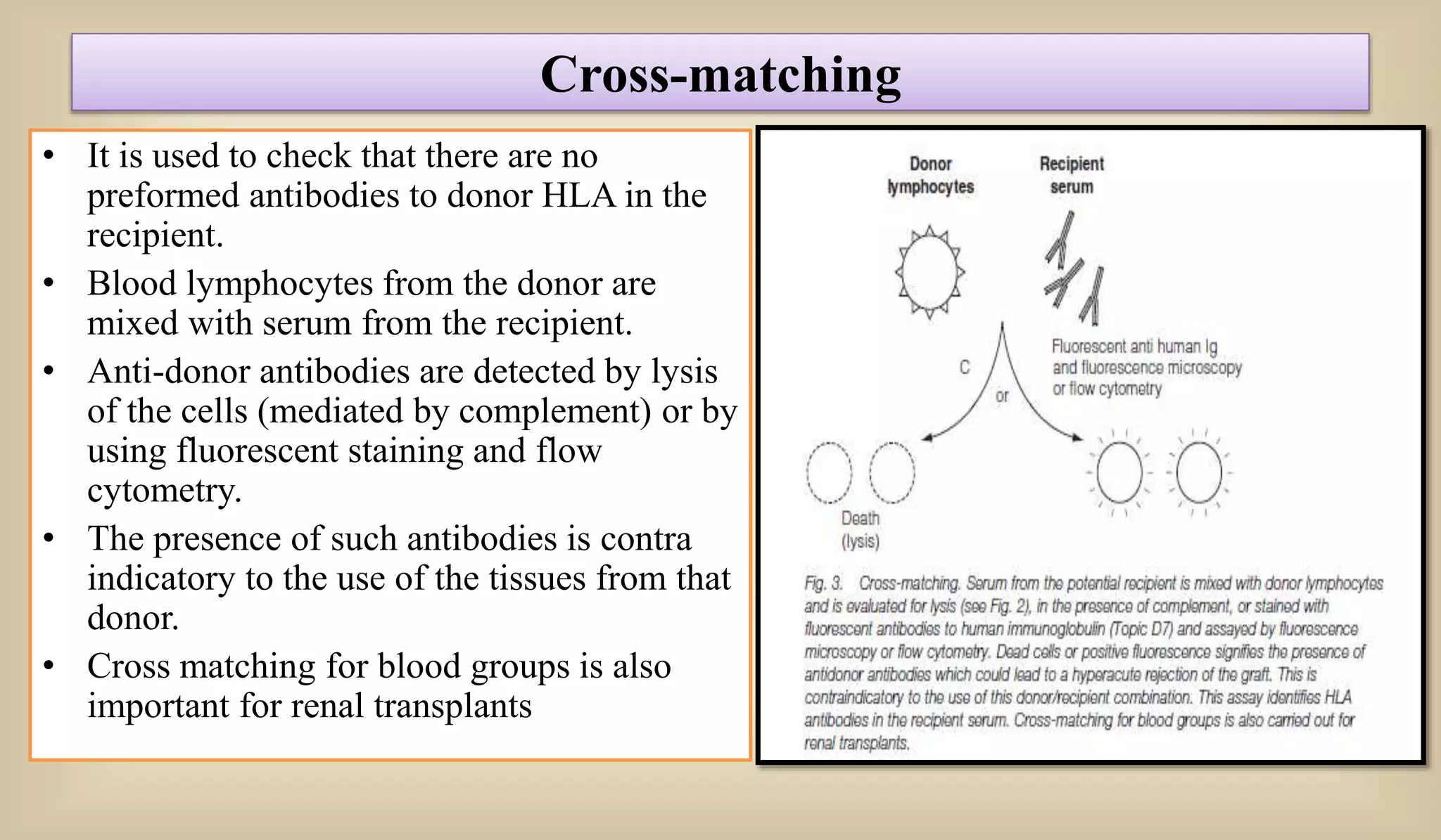 Cross-matching
• It is used to check that there are no
preformed antibodies to donor HLA in the
recipient.
• Blood lymphocytes from the donor are
mixed with serum from the recipient.
• Anti-donor antibodies are detected by lysis
of the cells (mediated by complement) or by
using fluorescent staining and flow
cytometry.
• The presence of such antibodies is contra
indicatory to the use of the tissues from that
donor.
• Cross matching for blood groups is also
important for renal transplants
 