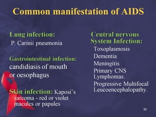 Common manifestation of AIDS 