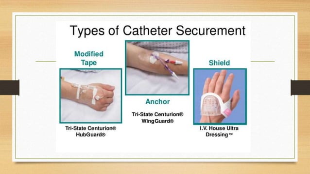 Prevention of iv complication | PPTX