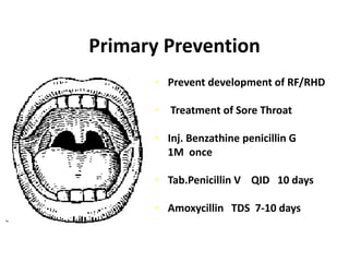 Prevention of RF/RHD | PPTX