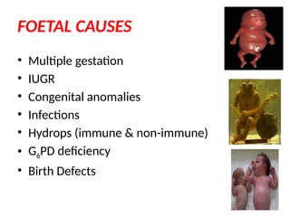 prevention of SB PG.pptx gyanecology SB. | PPTX