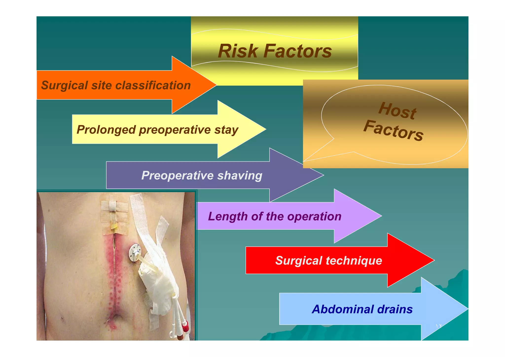 Risk Factors
Surgical site classification

Prolonged preoperative stay

Preoperative shaving
Length of the operation

Surgical technique

Abdominal drains
١٢

 