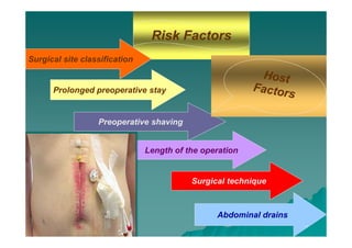 Prevention of Surgical Site Infection- SSI [compatibility mode] | PDF