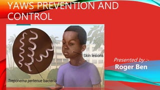 YAWS PREVENTION AND
CONTROL
Presented by :-
Roger Ben
 