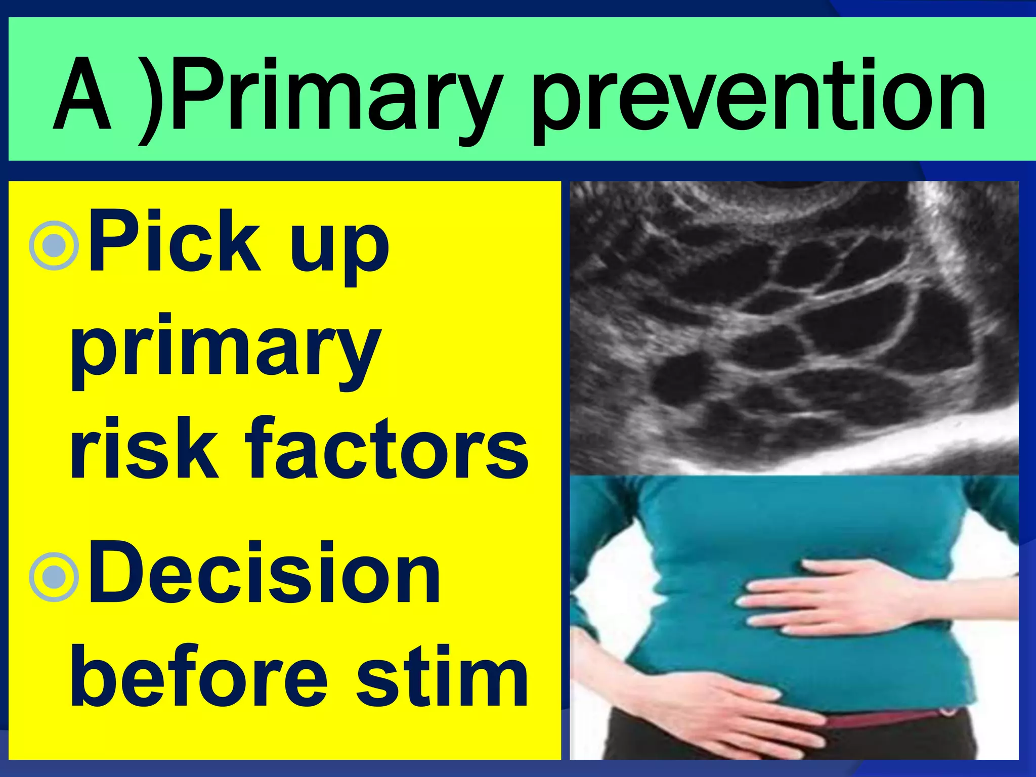 Prevention of Ovarian Hyperstimulation Syndrome ( OHSS ) | PDF