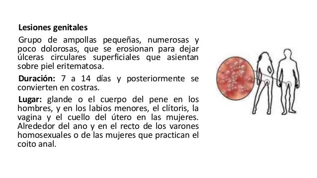 Si puede ser a la osteocondrosis de pecho la tos seca