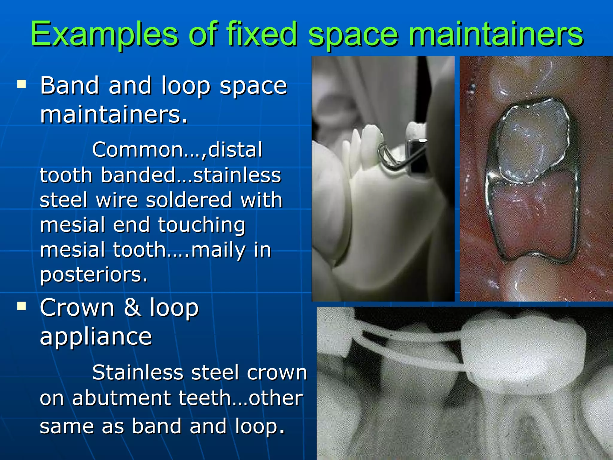 Preventive And Interceptive Orthodontics | PPT