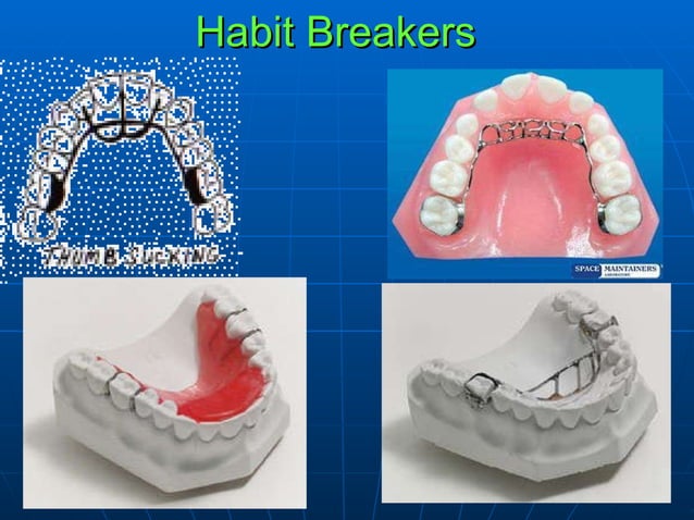 Preventive And Interceptive Orthodontics | PPT | Oral care | Personal Care