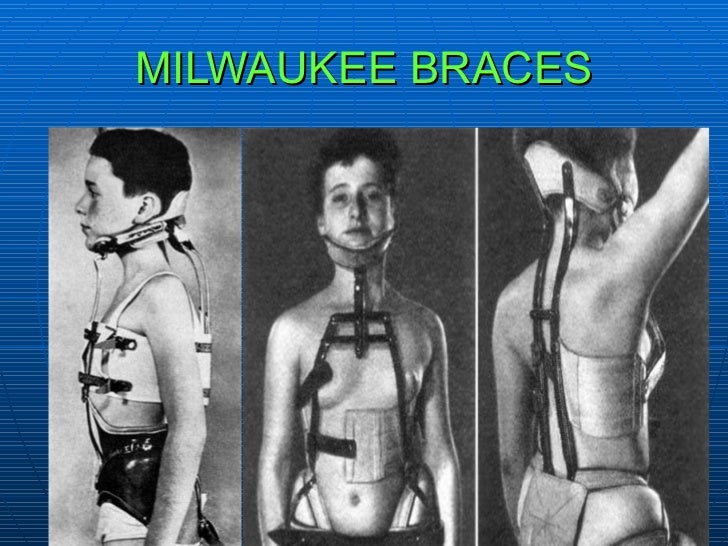 Preventive And Interceptive Orthodontics