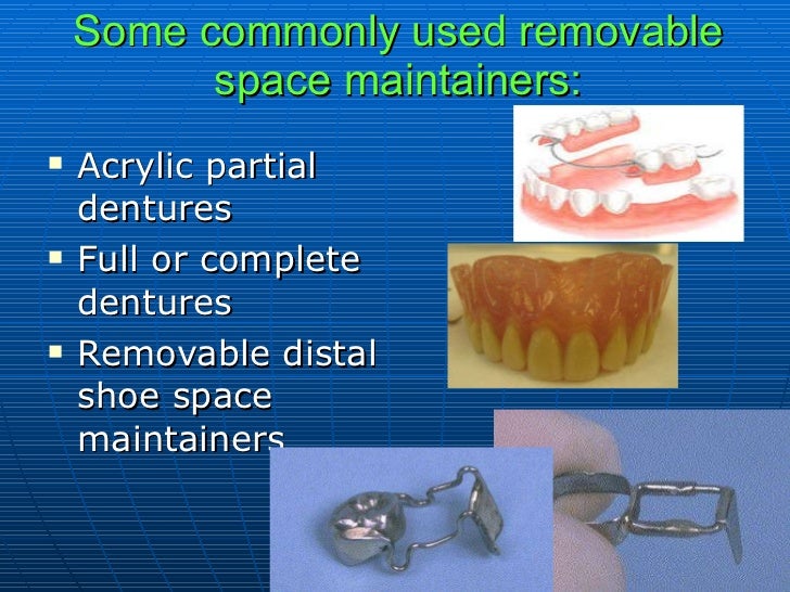 Roche Distal Shoe Space Maintainer Get Images