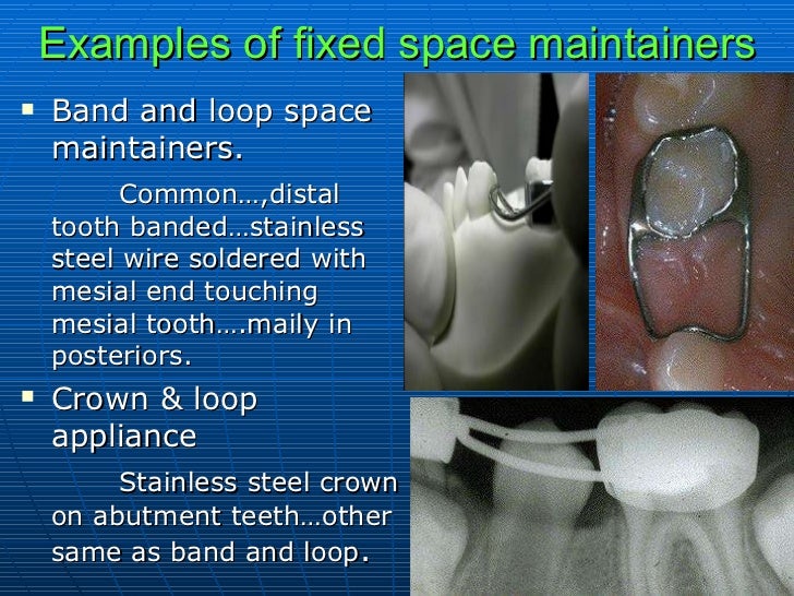 Preventive And Interceptive Orthodontics