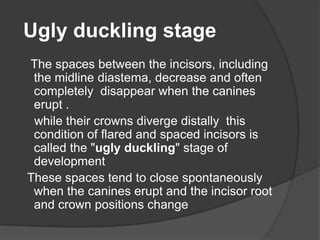 Ugly duckling stage
The spaces between the incisors, including
 the midline diastema, decrease and often
 completely disappear when the canines
 erupt .
 while their crowns diverge distally this
 condition of flared and spaced incisors is
 called the "ugly duckling" stage of
 development
These spaces tend to close spontaneously
 when the canines erupt and the incisor root
 and crown positions change
 