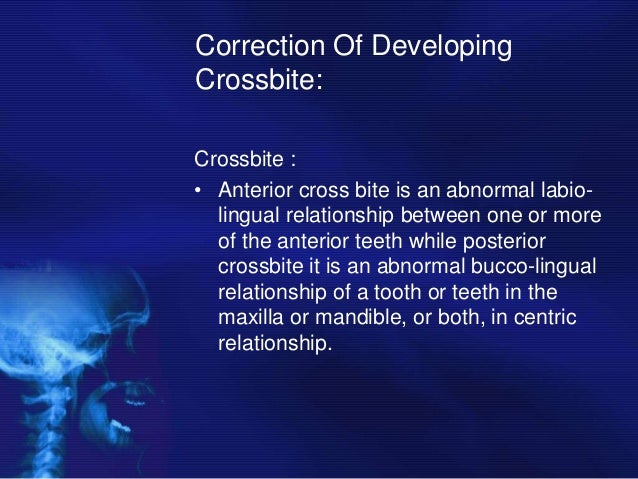 preventive pediactric interceptive orthodontics