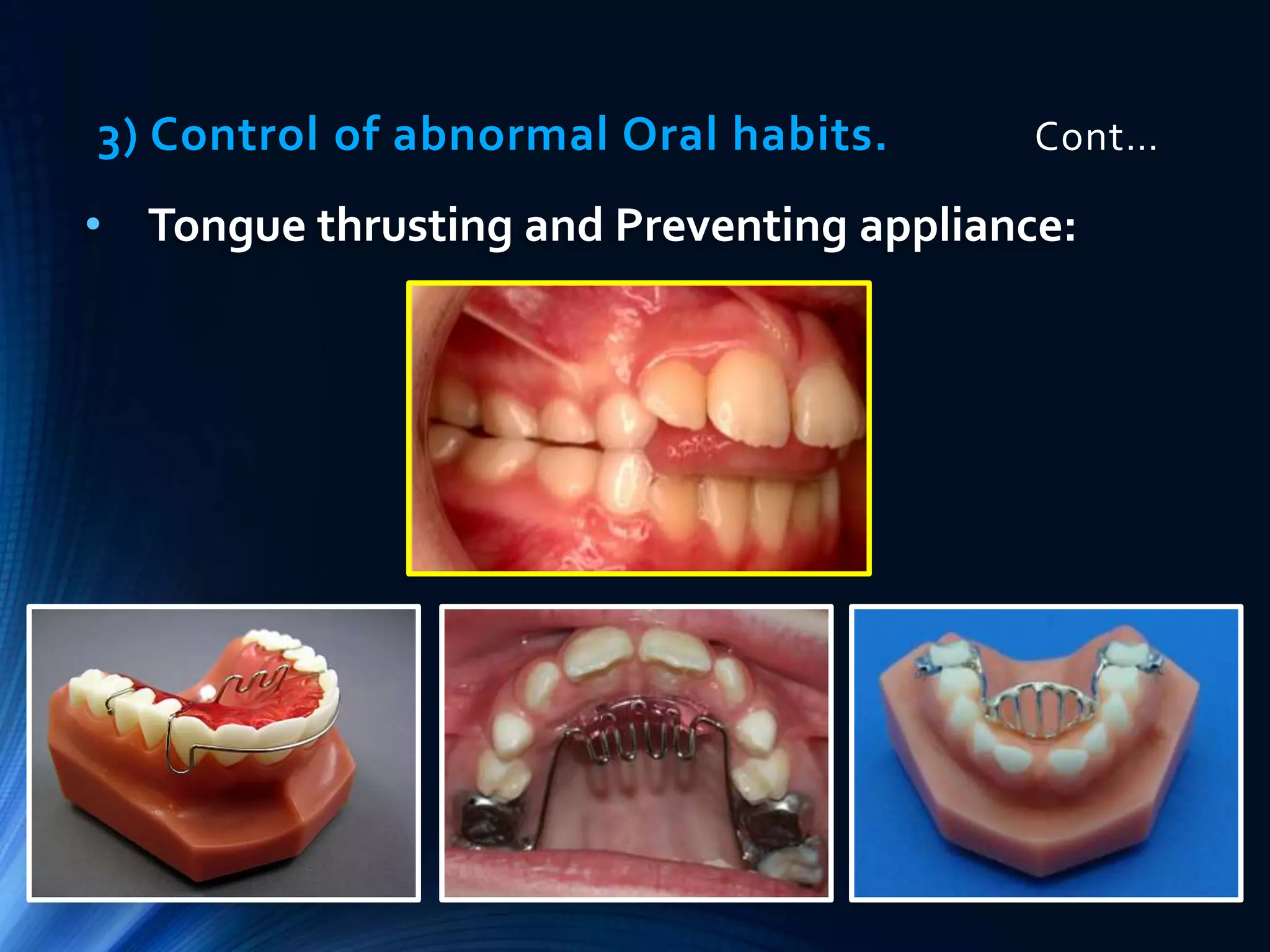 Preventive and interceptive orthodontics (basic) | PPTX