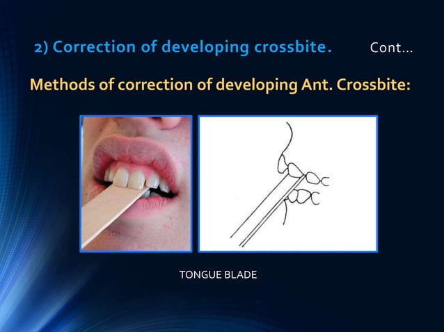 Preventive and interceptive orthodontics (basic) | PPTX