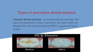 Types of preventive dental material
 Invasive dental material : are material that are used after the
caries for treatment in order to preventive the caries which are
damaged the root cannel( it prevents RTC), e.g. pit and fissure
sealant.
 