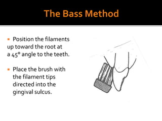  Position the filaments
up toward the root at
a 45° angle to the teeth.
 Place the brush with
the filament tips
directed into the
gingival sulcus.
Bass Method
 