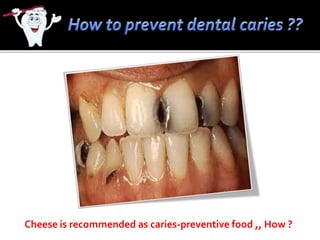 Cheese is recommended as caries-preventive food ,, How ?
 