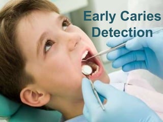 Early Caries
Detection
 