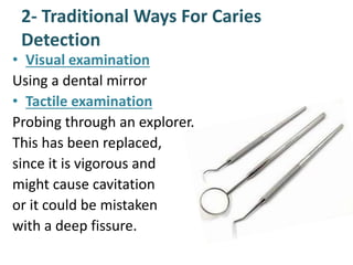 2- Traditional Ways For Caries
Detection
• Visual examination
Using a dental mirror
• Tactile examination
Probing through an explorer.
This has been replaced,
since it is vigorous and
might cause cavitation
or it could be mistaken
with a deep fissure.
 