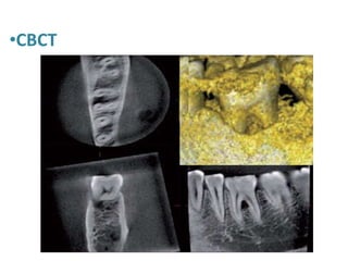 •CBCT
 