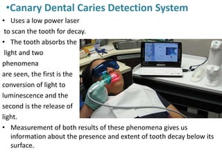 •Canary Dental Caries Detection System
• Uses a low power laser
to scan the tooth for decay.
• The tooth absorbs the
light and two
phenomena
are seen, the first is the
conversion of light to
luminescence and the
second is the release of
light.
• Measurement of both results of these phenomena gives us
information about the presence and extent of tooth decay below its
surface.
 