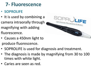 7- Fluorescence
• SOPROLIFE
• It is used by combining a
camera intraorally through
magnifying with adding
fluorescence.
• Causes a 450nm light to
produce fluorescence.
• SOPROLIFE is used for diagnosis and treatment.
• The diagnosis is made by magnifying from 30 to 100
times with white light.
• Caries are seen as red.
 