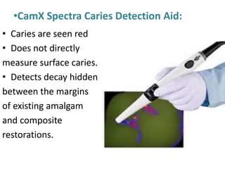 •CamX Spectra Caries Detection Aid:
• Caries are seen red
• Does not directly
measure surface caries.
• Detects decay hidden
between the margins
of existing amalgam
and composite
restorations.
 
