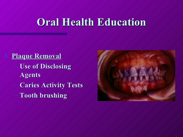 Preventive Dentistry Lecture Cde Course
