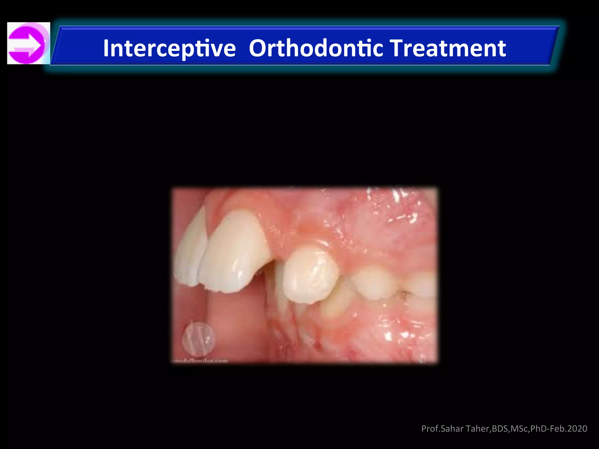 Preventive & Interceptive Orthodontics-Prof.Sahar Taher, Feb.2020 | PDF