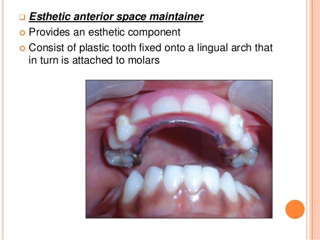 Preventive orthodontic procedure