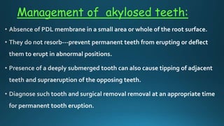 Management of akylosed teeth:
 