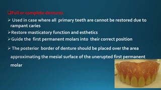Full or complete dentures
 