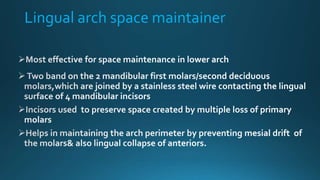 Lingual arch space maintainer
 