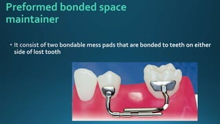 Preformed bonded space
maintainer
 