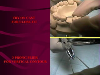 TRY ON CAST
FOR CLOSE FIT
3 PRONG PLIER
FOR VERTICAL CONTOUR
 
